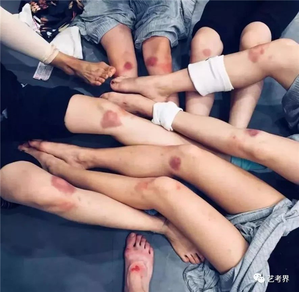 跌���的伤�? width=